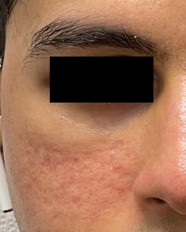After Image