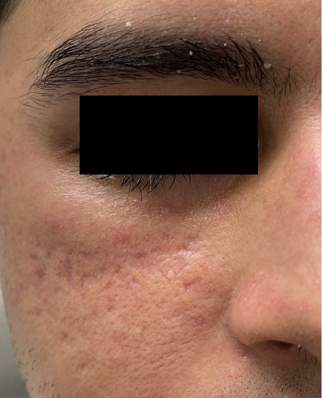 Before Image