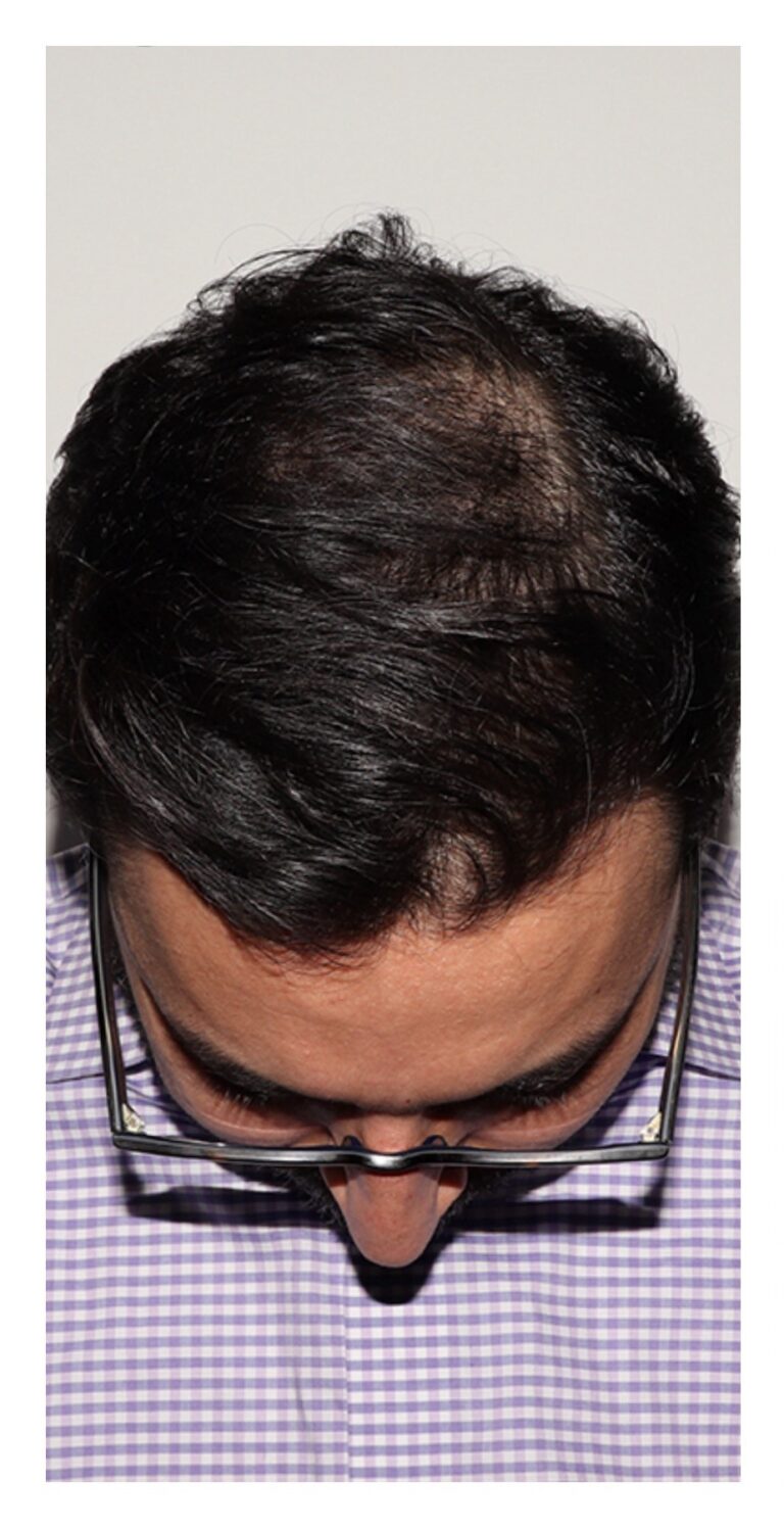 Before Image