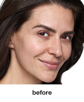 Before Image