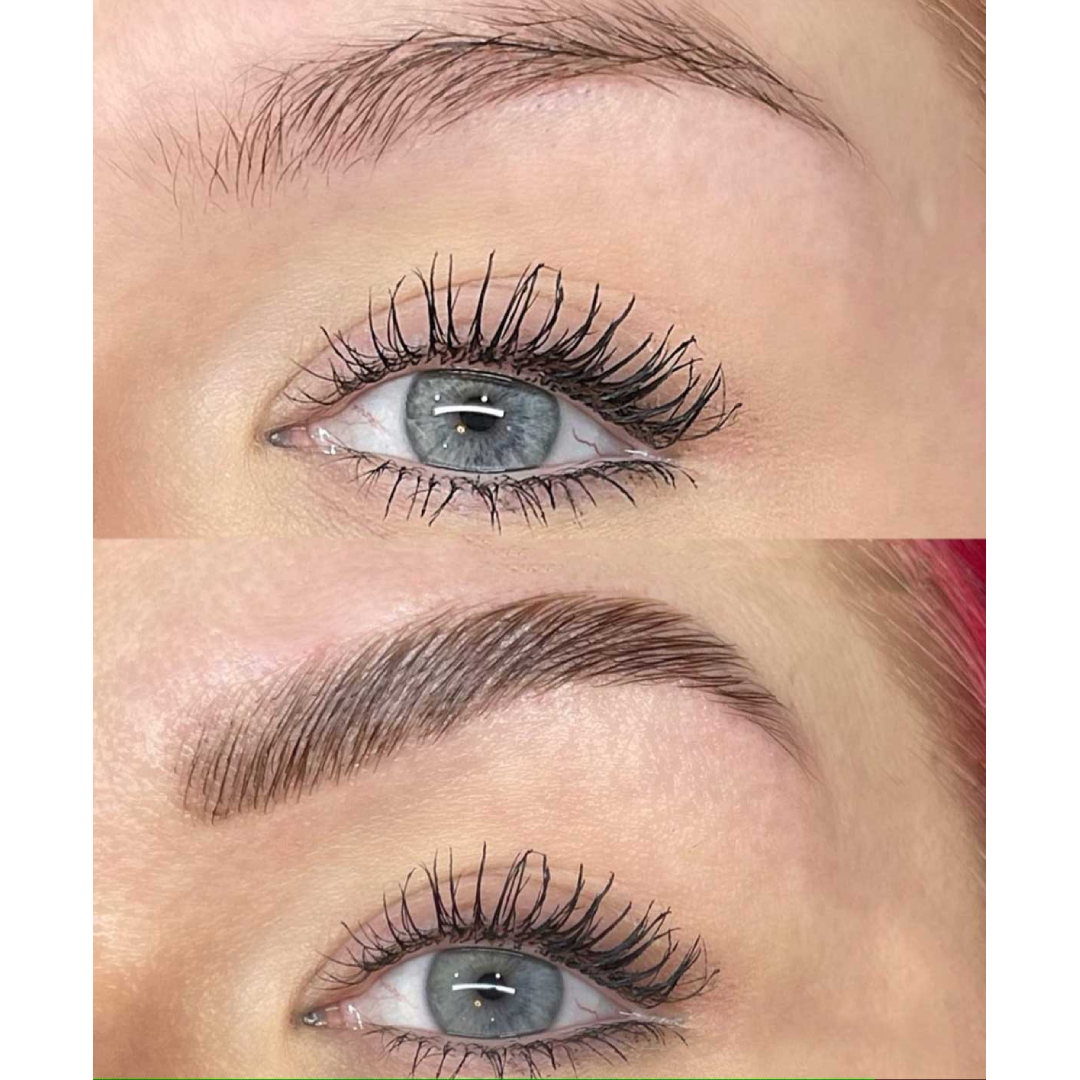 brow before and after