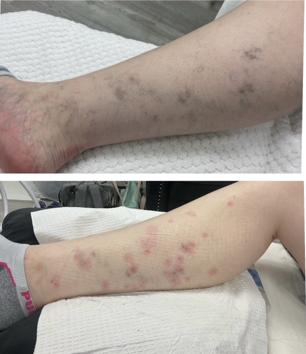 before and after
