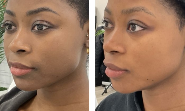 peel b&a