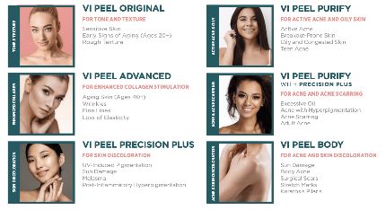type of peel