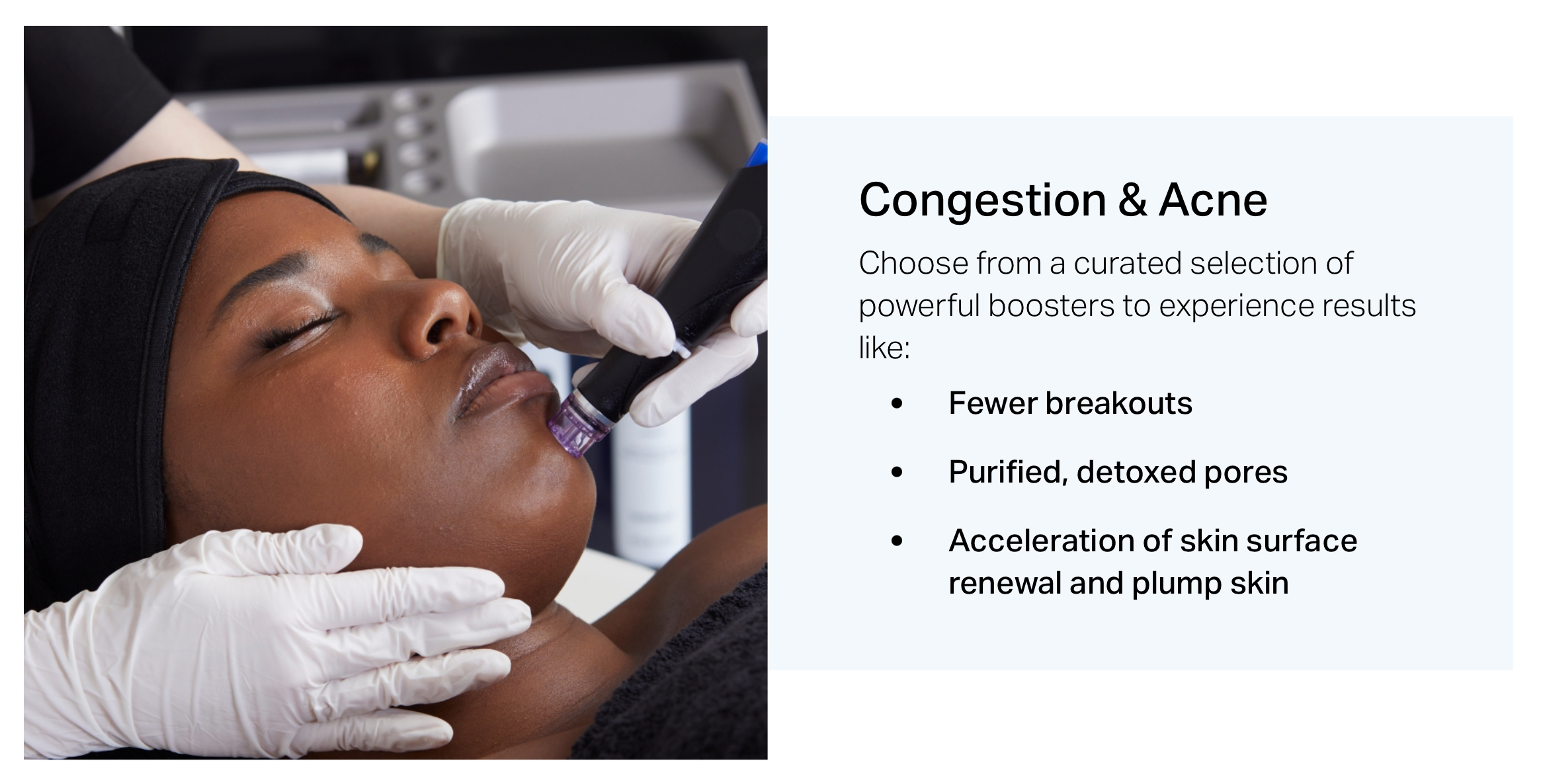 Acne & Congestion