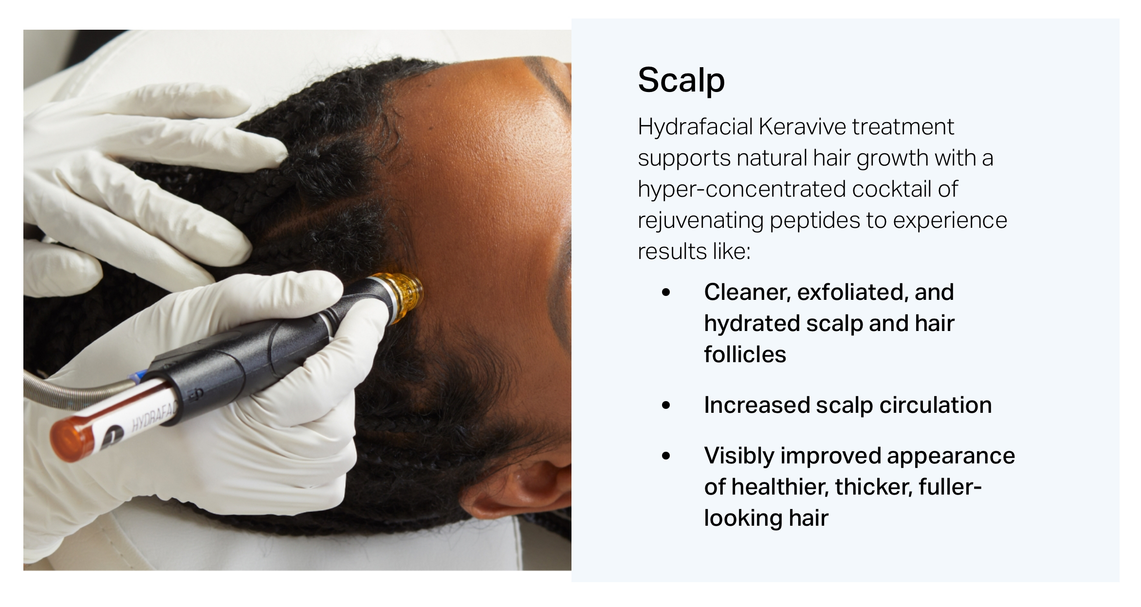 Scalp with Keravive