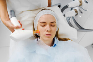 Removal rosacea of dilated small vessels on patient face with IPL ultrasound laser. Laser treatment of rosacea by dermatologist. Painless rosacea treatment in beauty clinic.