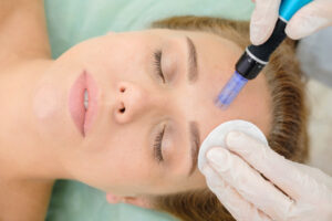 Beautiful woman looking refreshed and radiant while receiving a microneedling treatment