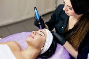 Close up of a woman smiling while getting a Rejuvapen microneedling treatment from her provider.